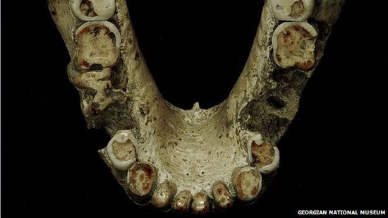 研究人员称:180万年前牙签或已被人类使用